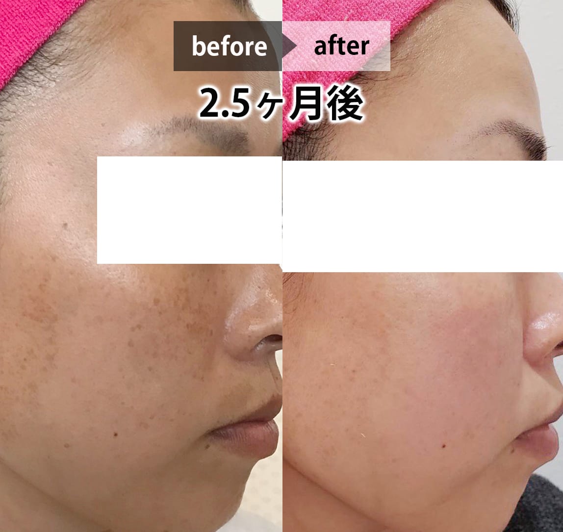 フェイシャル画像 10