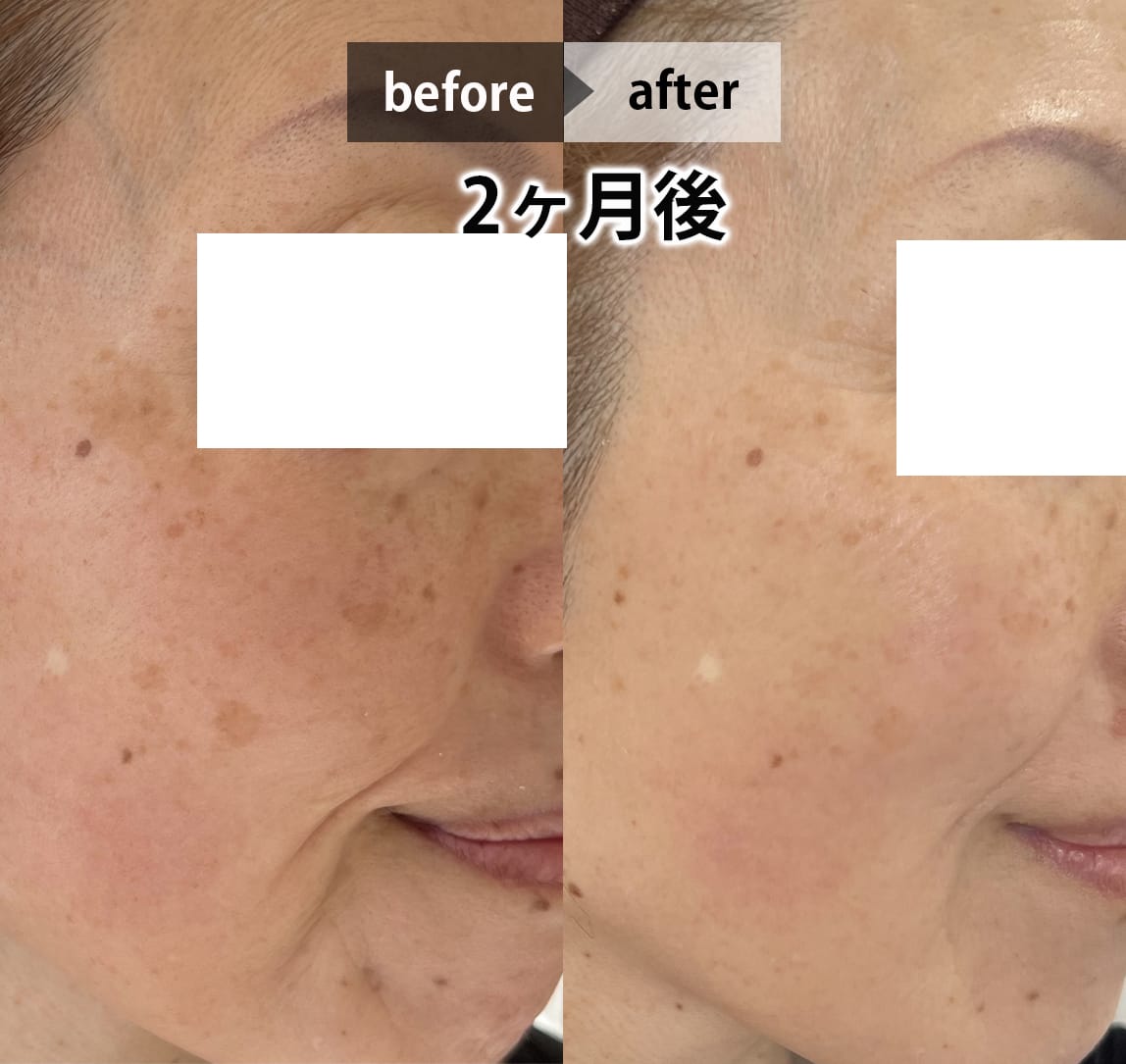 フェイシャル画像 11