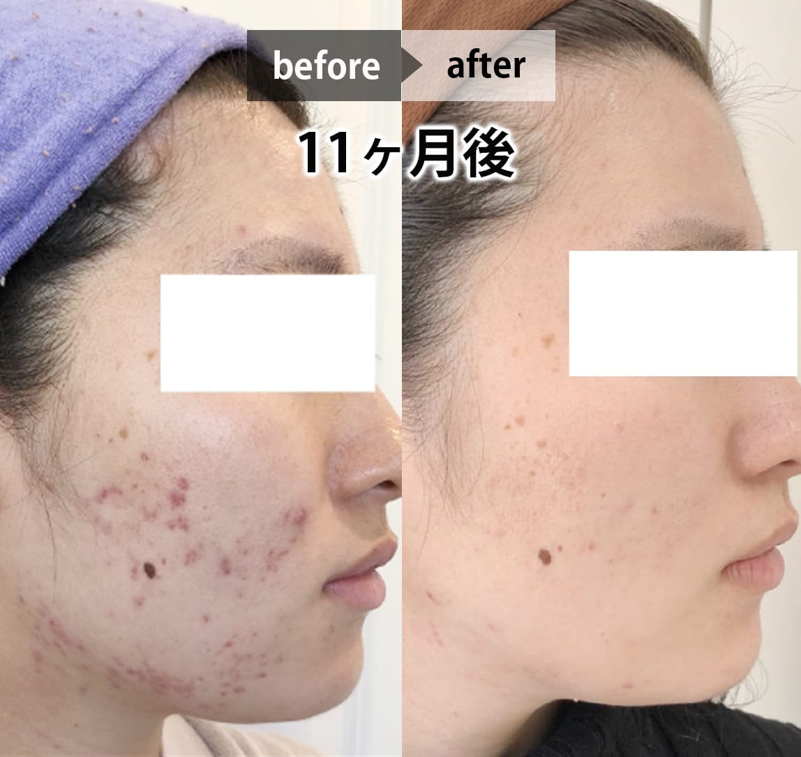 フェイシャル画像 2