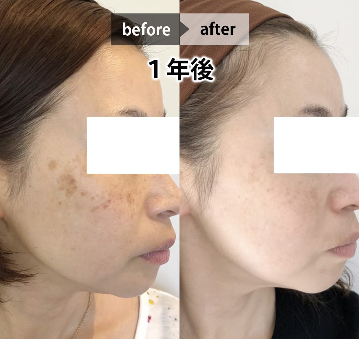 フェイシャル画像 3