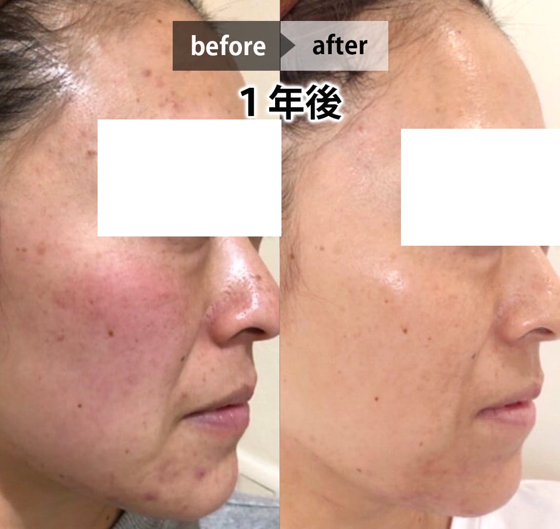 フェイシャル画像 7