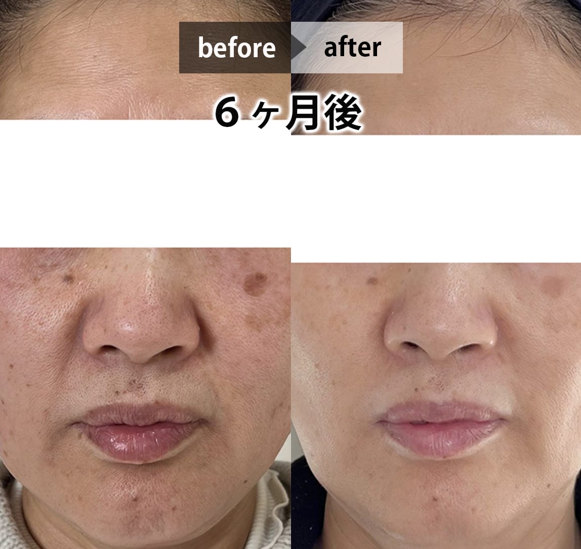 フェイシャル画像 8