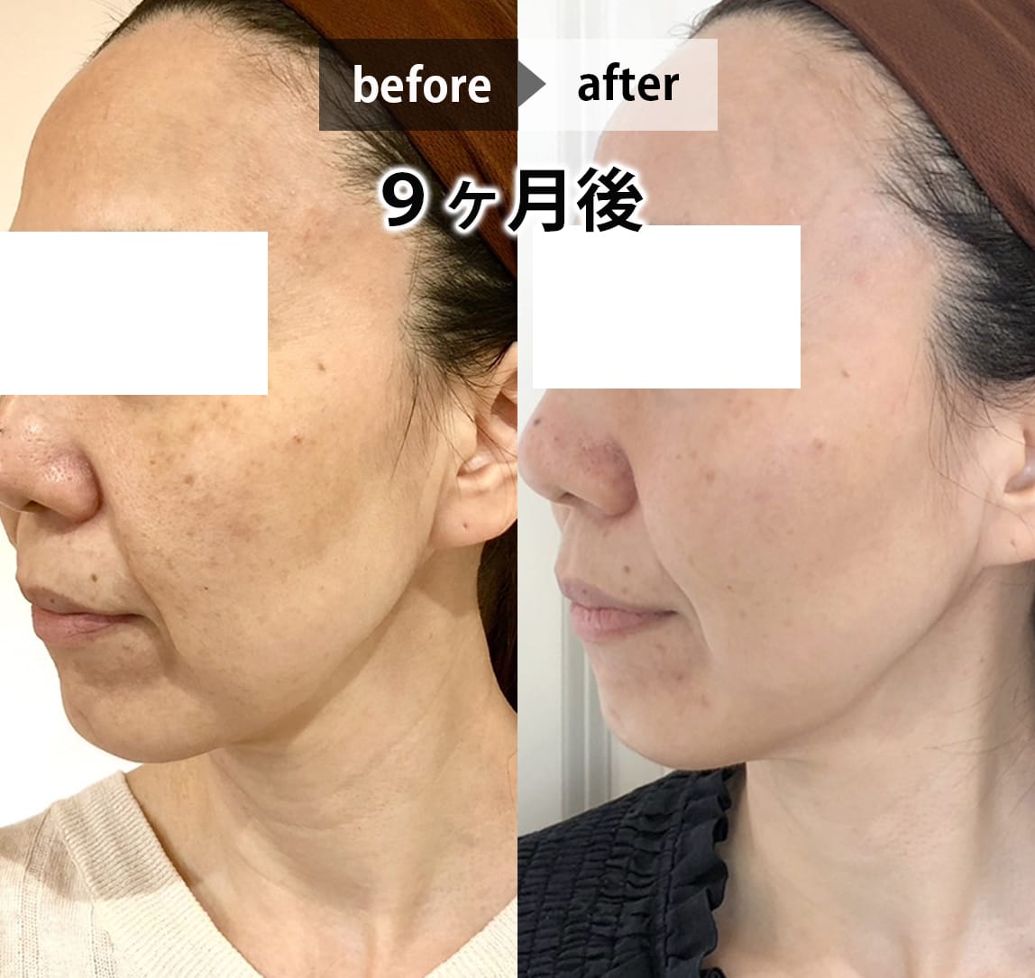 フェイシャル画像 9